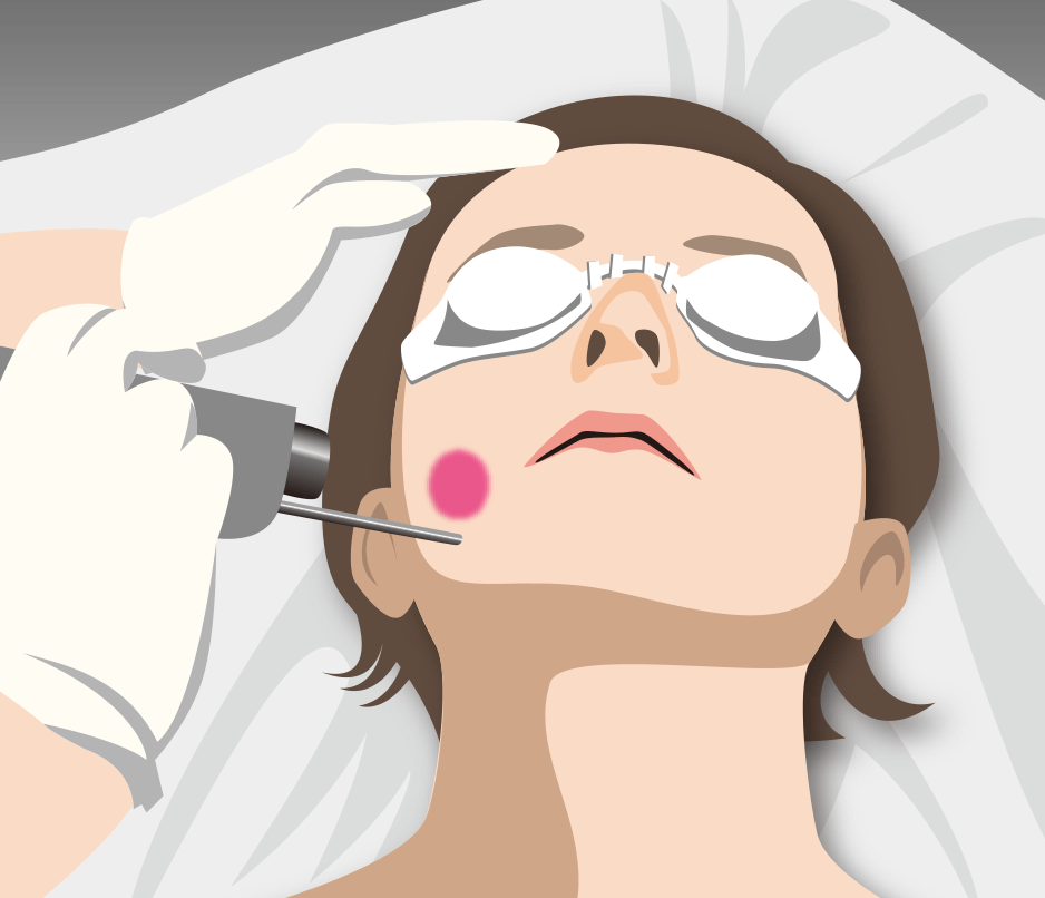 ピアノ(皮膚深部タイトニング)