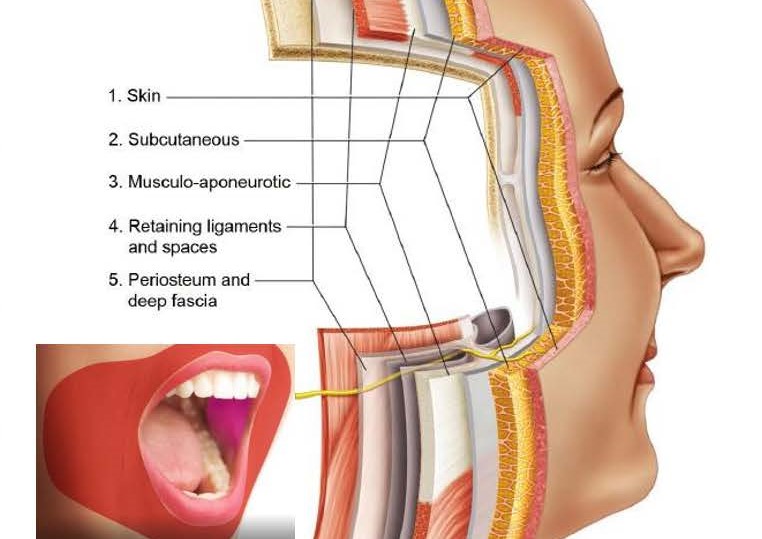 6Dロボテックリフト