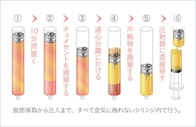 コンデンスリッチファットの流れ