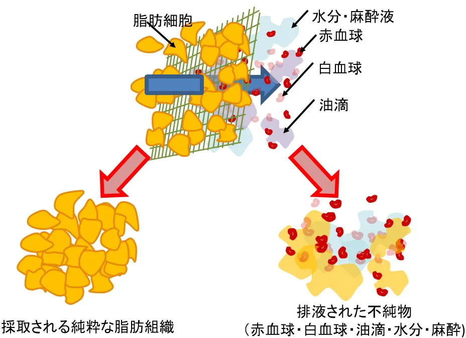 ピュアグラフトの流れ