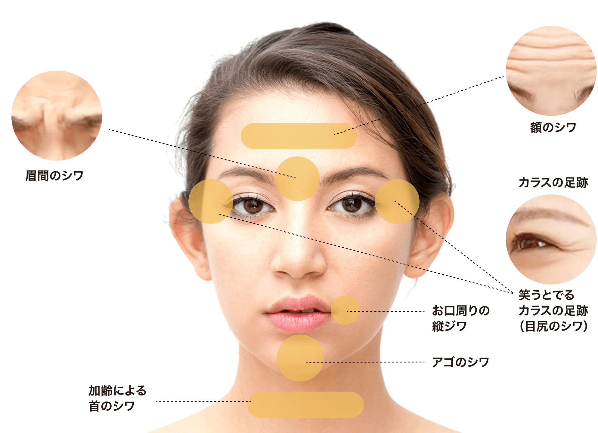 しわの出る部位