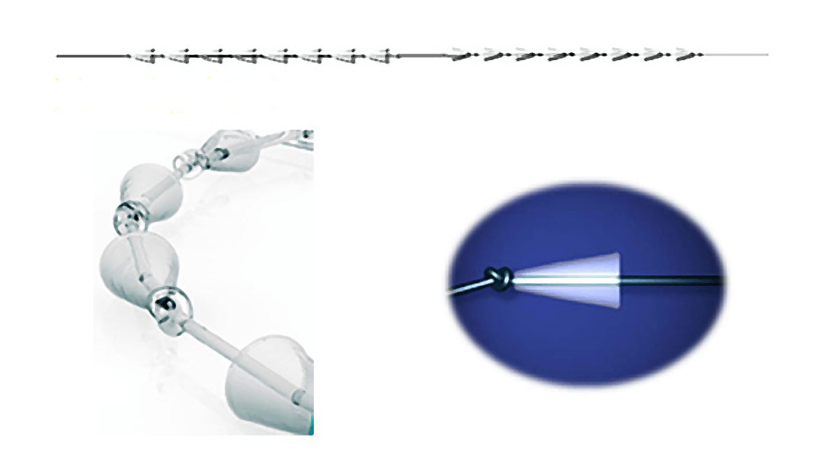 シルエットリフト(3Dリフト)