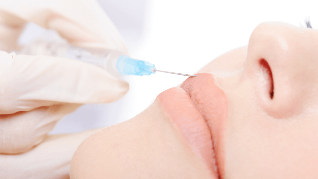 ヒアルロン酸注入