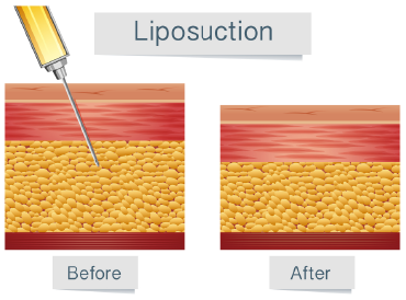 カウンセリング